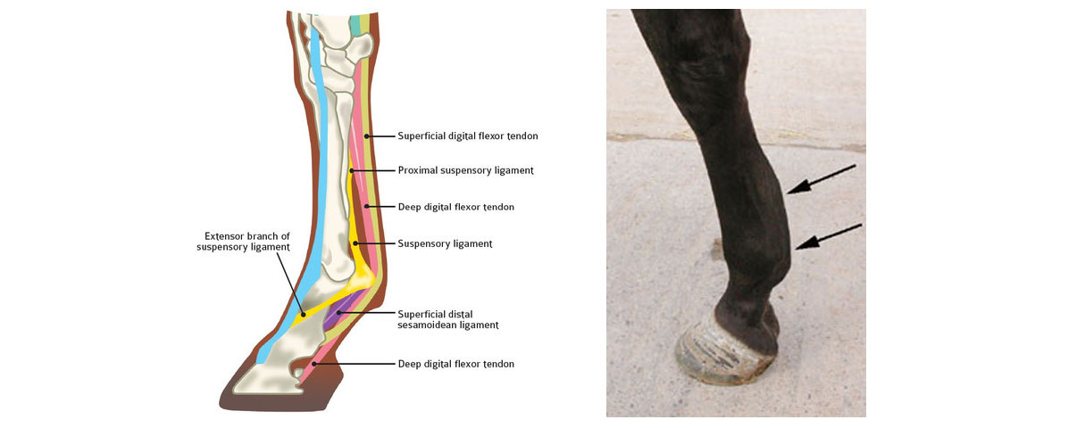 Common Tendon and Leg Injuries